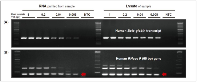 DRT_Figure 2. Comparison of amplification efficiency of direct RT-PCR with conventional RT-PCR from whole blood (A) or buccal swab (B).